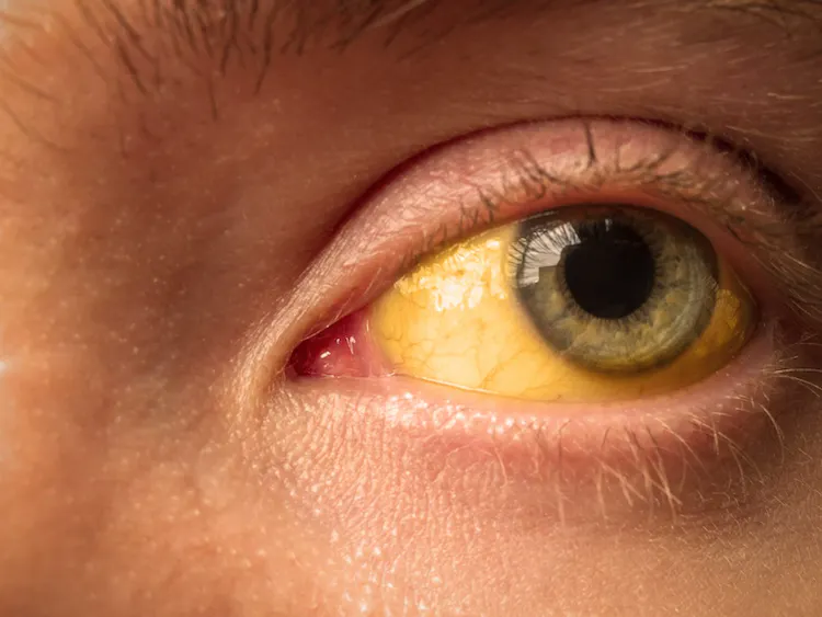 yellow-eyes